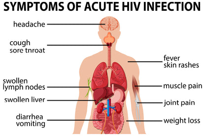 Chart Of Symptoms of Acute HIV Infection Home Decor Premium Quality Poster Print Choose Your Sizes