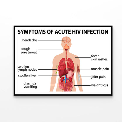 Chart Of Symptoms of Acute HIV Infection Home Decor Premium Quality Poster Print Choose Your Sizes