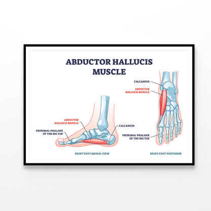 Abductor Hallucis Muscle with Leg Home Decor Premium Quality Poster Print Choose Your Sizes