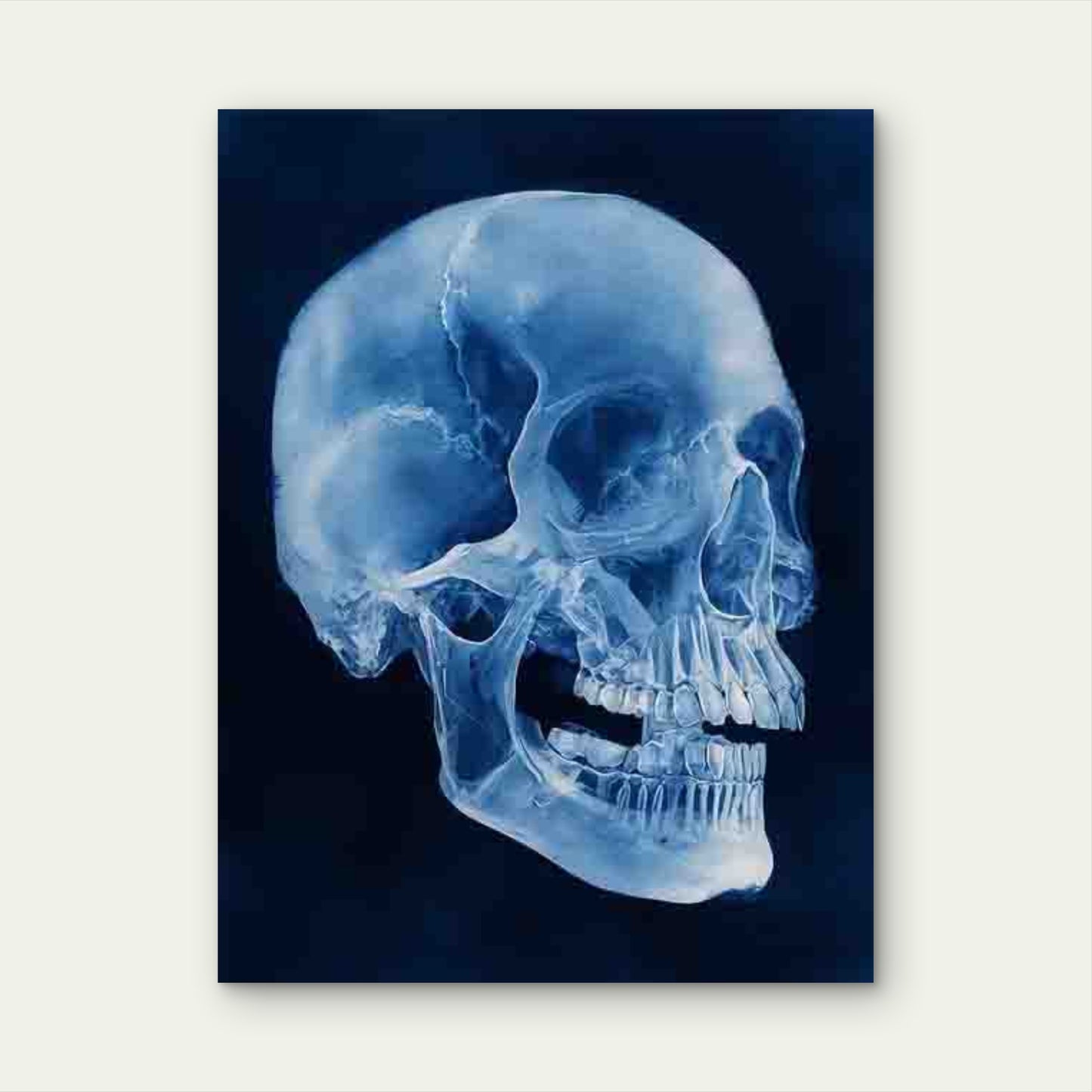 Skull Teeth Pan X-Ray Dental Anatomy 60x90cm Metal Print Ready to Hang